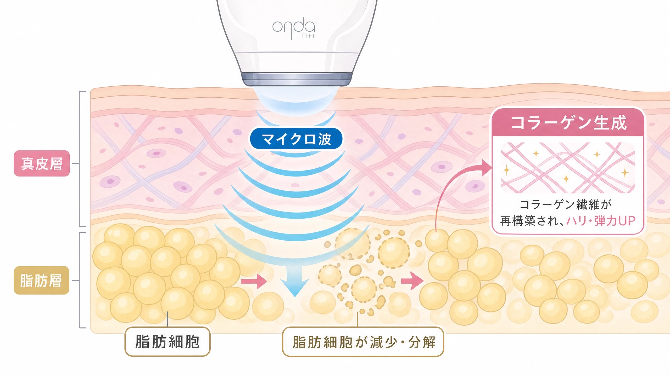 オンダリフトの仕組み図解