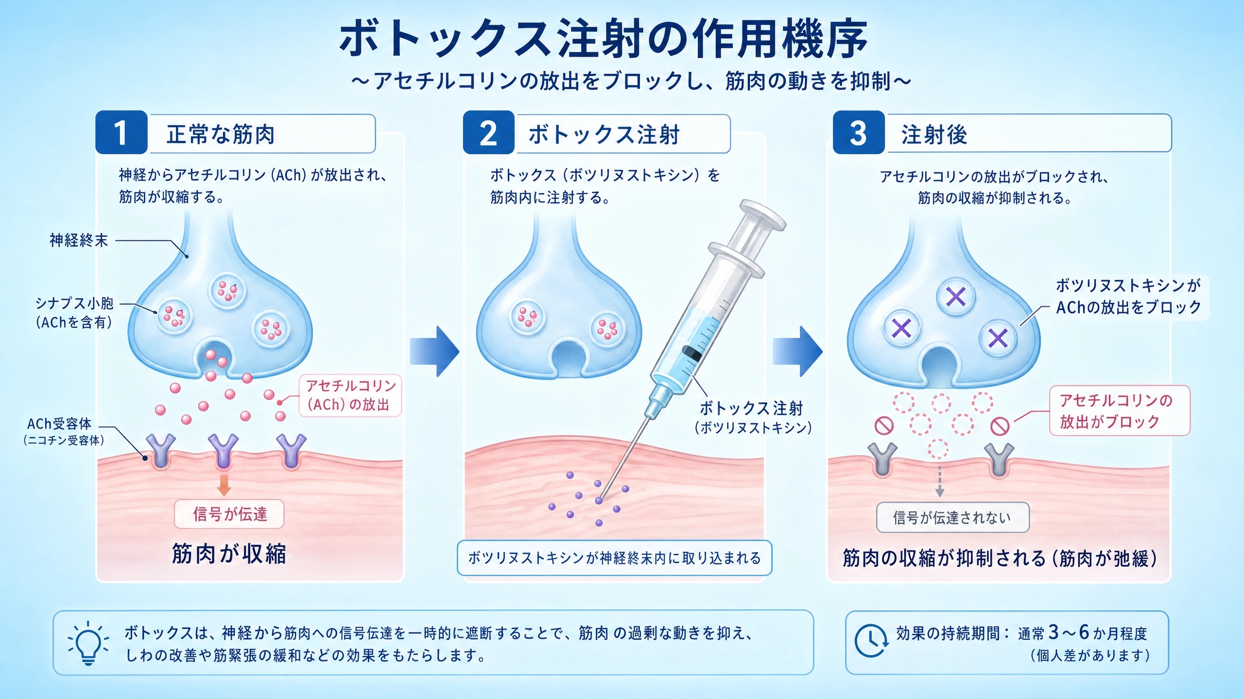 ボトックス注射の作用機序
