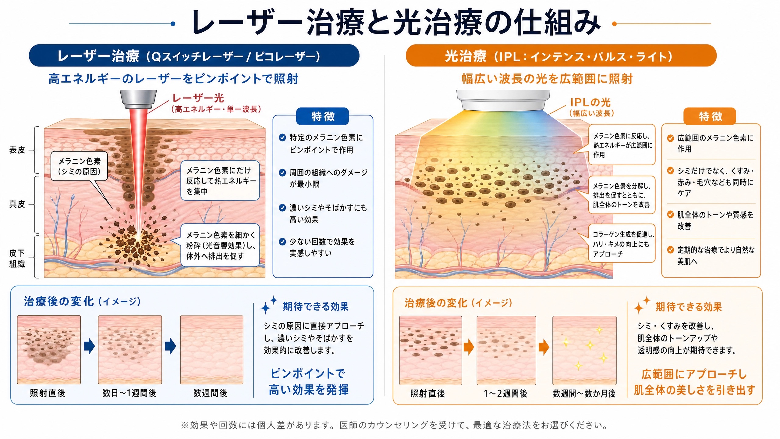 レーザー治療と光治療の仕組み