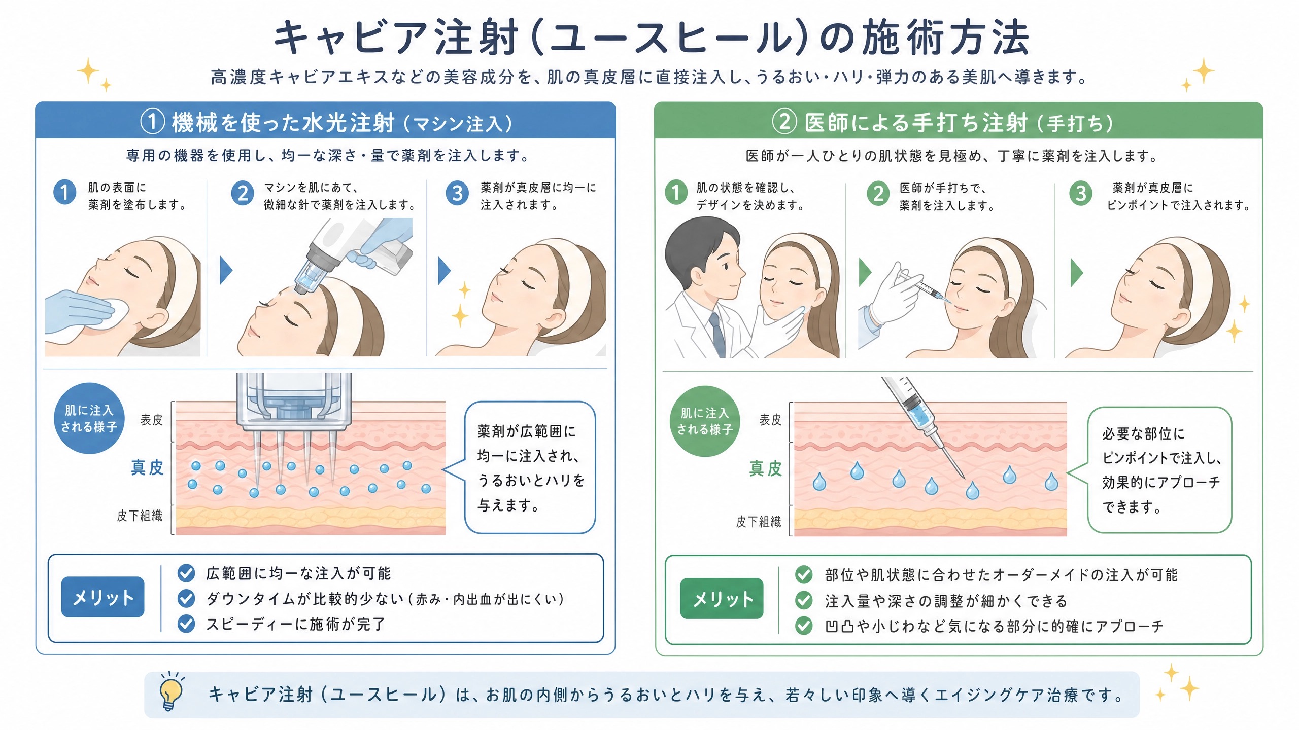 キャビア注射(ユースヒール)の施術方法