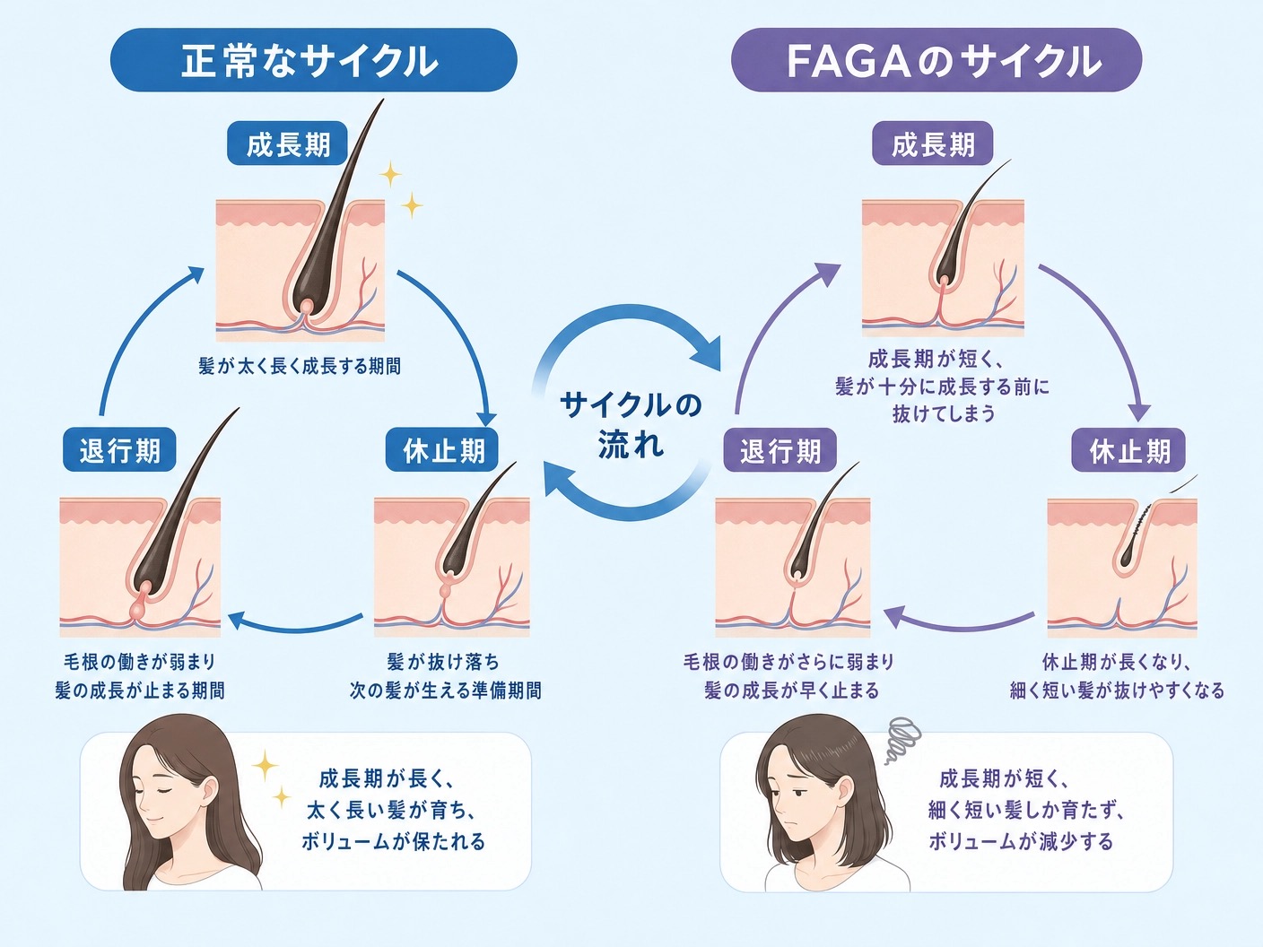 女性のヘアサイクルの乱れ（正常vsFAGA）